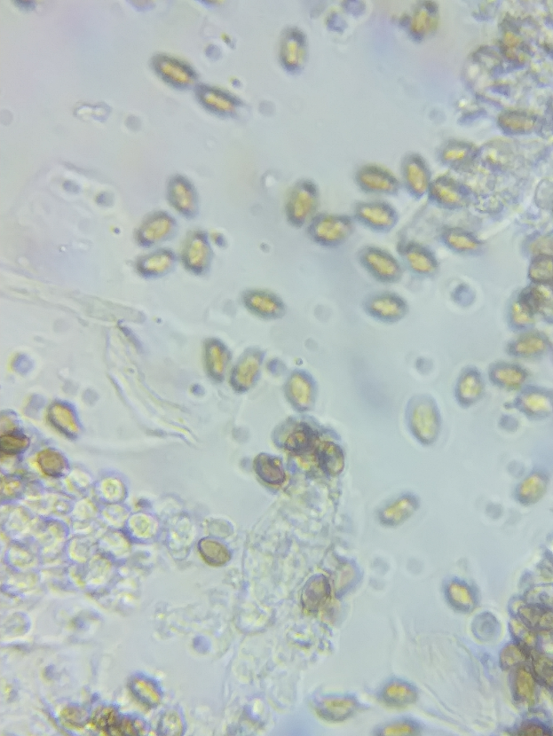 Ein Nahaufnahme-Mikroskopbild von kleinen,.clusterierten Mikroorganismen.