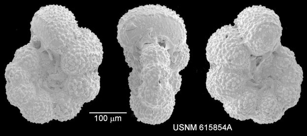Schwarz-weißes mikroskopisches Bild von drei verschiedenen Arten von Krebszellen auf einem dunklen Hintergrund mit dem Text "USNM 615854A" unten.